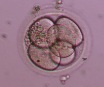 5-cell Grade II